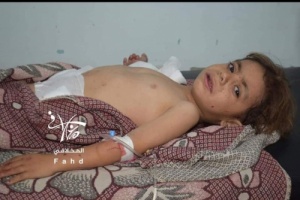 الحوثيون يرتكبون مجزرة جديدة في تعز والضحايا اطفال