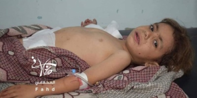 الحوثيون يرتكبون مجزرة جديدة في تعز والضحايا اطفال