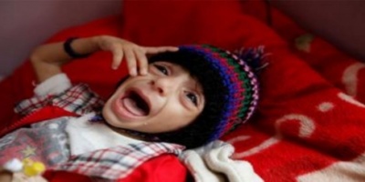 يونيسف: 66 ألف طفل يمني يموتون سنويا بأمراض يمكن الوقاية منها