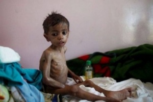 الأمم المتحدة: ملايين اليمنيين بحاجة للأمن الغذائي