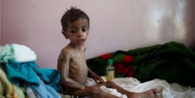 الأمم المتحدة: ملايين اليمنيين بحاجة للأمن الغذائي