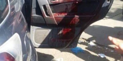 عاجل : اصابة رئيس جامعة تعز اثر محاولة اغتيال