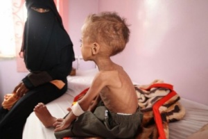 اليمن تتجاوز سوريا في حاجتها للمساعدات 
