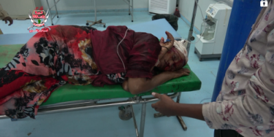 اصابة امرأة مسنة أخرى بشظايا قذيفة هاون قصفتها الميليشيات على مدينة حيس