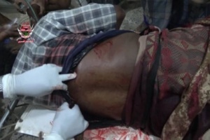 إصابة رجل وامرأة برصاص قناصة الحوثي في حيس 