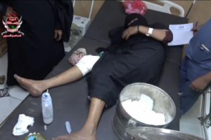 قناص #الحـوثي يصيب امرأة في الجبلية بالحديدة 