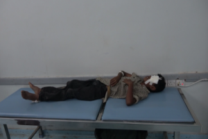إصابة طفل في قصف حوثي على منازل المواطنين والاحياء السكنية في حيس