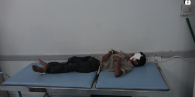 إصابة طفل في قصف حوثي على منازل المواطنين والاحياء السكنية في حيس