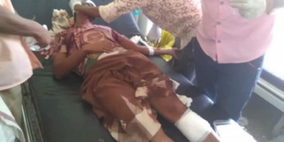 سقوط قذيفة هاون على قرية المغل في حيس وإصابة مواطن بجروح خطيرة