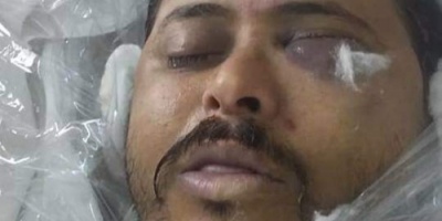 مقتل نجل رئيس إصلاح مأرب في مواجهات مع الاشرف