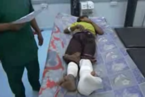 إصابة طفل برصاص قناصة الحوثي في مديرية التحيتا