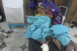 إصابة طفلة بإنفجار لغم من مخلفات مليشيات الحوثي في الحديدة