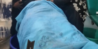 إصابة إمرأة مسنة في مريس شمال الضالع برصاص قناص حوثي  