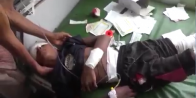 مليشيات الحوثي تطلق النار وتصيب طفل يرعى الأغنام في حيس