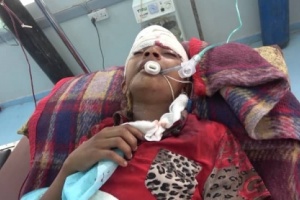 إصابة طفلين بقصف مدفعي لمليشيات الحوثي على منازل المواطنين في التحيتا