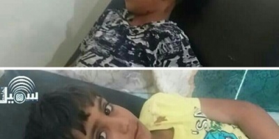 مريس :مليشيا الحوثي تقصف قرية اللكمة خلال حفل عرس واصابات في صفوف الاطفال والنساء