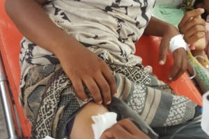 سقوط جرحى بينهم طفل في سن ١٣ من العمر بنيران مليشيا الحوثي في الحديدة 