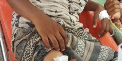 سقوط جرحى بينهم طفل في سن ١٣ من العمر بنيران مليشيا الحوثي في الحديدة 