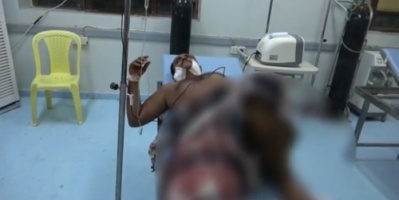 قناصة الحوثي تسفك دماء المواطنين وتروع النساء والأطفال في الحديدة