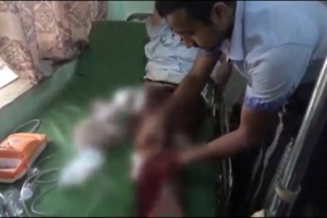 إصابة رجل مسن برصاص قناصة الحوثي في الحديدة 