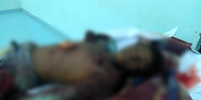 لغم حوثي يخطف حياة عبده يوسف أثناء خروجه لرعي الأغنام في قرية اليابلي