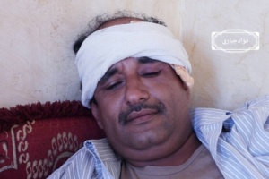 الضالع: عناصر المليشيات الحوثية تستهدف أحد المدنيين بطلق ناري في رأسه بحجر