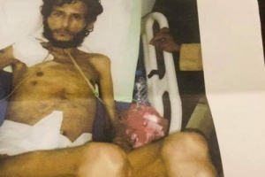 وفاة جريح جنوبي لعدم حصوله على جواز سفر للعلاج في الخارج 