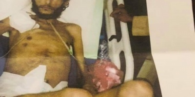 وفاة جريح جنوبي لعدم حصوله على جواز سفر للعلاج في الخارج 