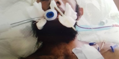 هو الثاني خلال اقل من 24 ساعة  .. وفاة جريح من ابطال قوات العمالقة الجنوبية بعد تعثر حصوله على جواز سفر 