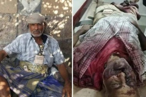 مقتل شيخ قبلي على يد الحوثيين في منطقة العود بمحافظة اب . 