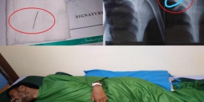  معتقل هرب من سجن بشبوة يكشف عن تعذيب وحشي تنفذه مليشيا الاصلاح بحق المعتقلين ( وثائق)