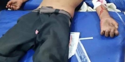 الضالع..إستشهاد طفل بقرية المشاريح في حجر بشظايا قذيفة هاون لمليشيا الحوثي 