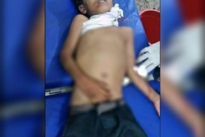 استشهاد طفل في حجر بقذيفة أطلقتها قوات المليشيات الحوثية 