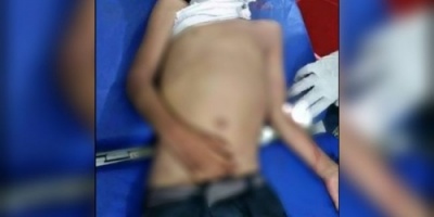 استشهاد طفل في حجر بقذيفة أطلقتها قوات المليشيات الحوثية 