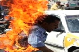 مواطن يقدم على إحراق نفسة والسبب أحد القيادات الحوثية 