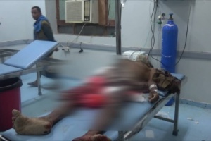 إستشهاد مواطن جراء قصف مدفعي شنته مليشيات الحوثي على منطقة الفازة