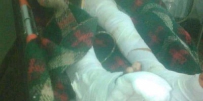 إصابة طفل بجروح خطيرة إثر انفجار بقايا مقذوف متفجر وسط منطقة حجر