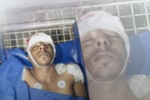 تعز.. استشهاد وإصابة أربعة من أسرة نازحة بقصف حوثي