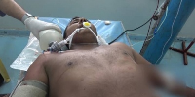 إصابة مواطن بإنفجار لغم من مخلفات الحوثي في الخوخة جنوب الحديدة