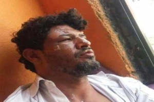 تعز... محاولة اغتيال ناشط سياسي