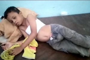 مدفعية الحوثي تقصف حيس وتصيب طفلا