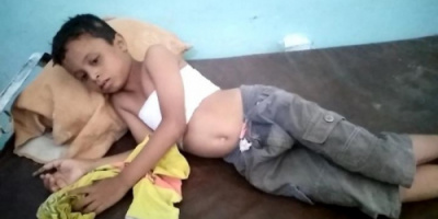 مدفعية الحوثي تقصف حيس وتصيب طفلا