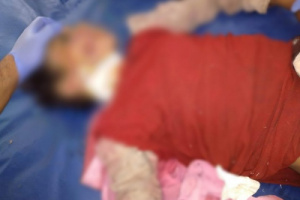 قناص حوثي يقتل طفلة شمالي الضالع