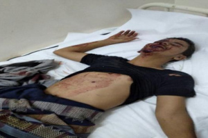  مقتل شخص واصابة اثنين اخرين اثر قصف حوثي استهدف شمالي لحج