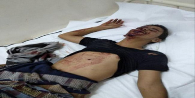  مقتل شخص واصابة اثنين اخرين اثر قصف حوثي استهدف شمالي لحج
