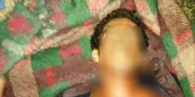 مصرع وجرح عدد من عناصر المليشيات إثر محاولتهم انتشال جثث وزرع عبوات شمال الضالع
