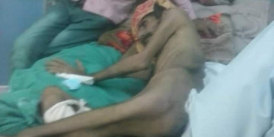 شقيق الجريح الحوشبي من أبناء الضالع يناشد فاعلين الخير لإنقاذ أخوه 