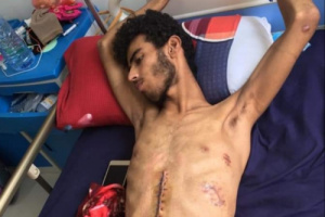 جريح تتعفن أعضاء ويتوغل فيه الشلل وأسرته تناشد الانتقالي تسفيره إلى الخارج لتلقي العلاج