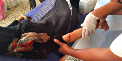 في جريمة جديدة… إصابة امرأتان برصاص قناص حوثي في المشاريح ومريس شمال الضالع