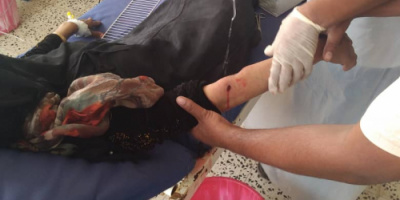 قناصة المليشيات الحوثية تستهدف ثلاث نساء في مناطق متفرقة شمال غرب محافظة الضالع